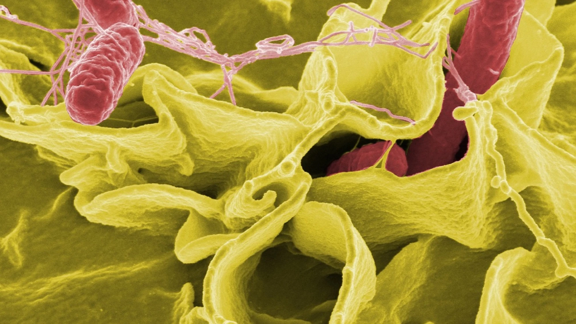 Bacteria intestinal con ácido sulfúrico nos protege contra la salmonella